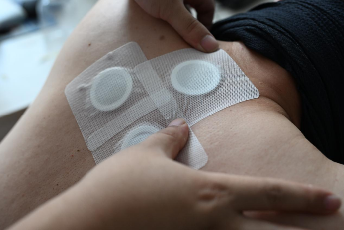 山东即墨：入伏首日 冬病夏治